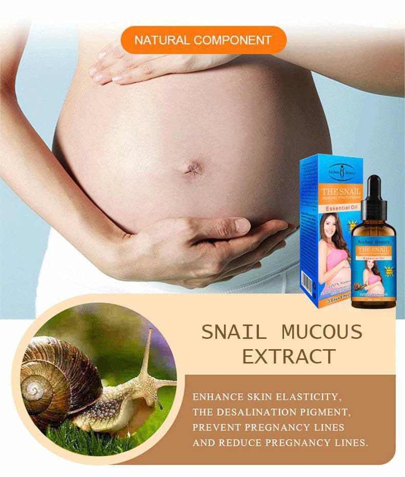 Snail Stretch Marks Removal BCollections